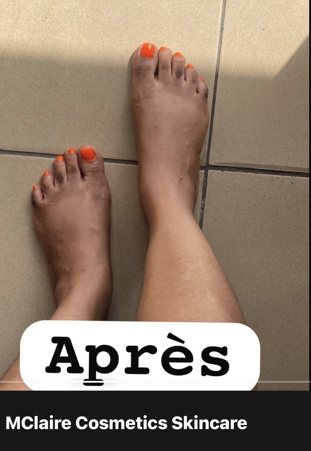 Après – soins corps